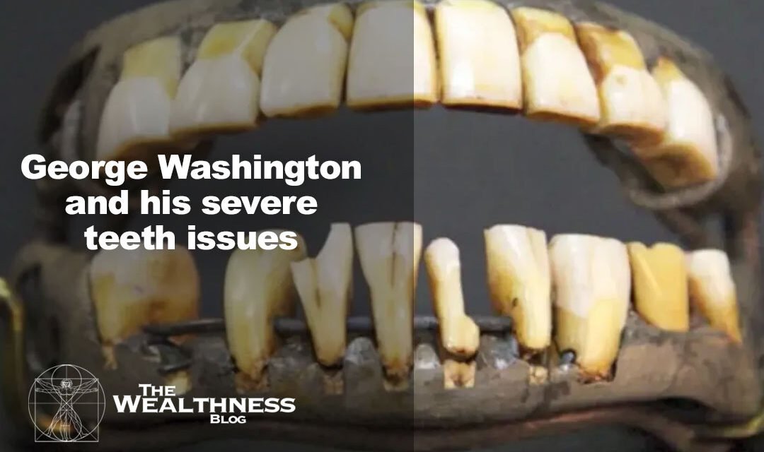 George Washington and his severe teeth issues